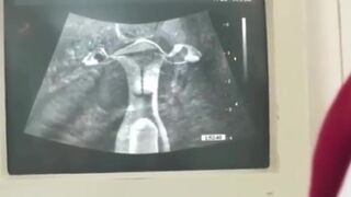 अल्ट्रासाउंड कराने आई लड़की डॉक्टर से चुद गयी